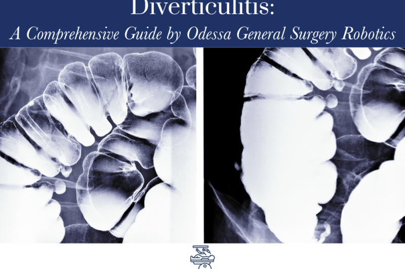 Diverticulitis: A Comprehensive Guide by Odessa General Surgery Robotics