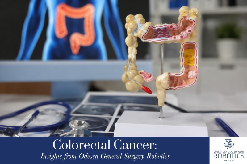 Colorectal Cancer Insights from Odessa General Surgery Robotics 1