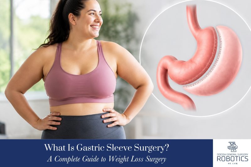 What Is Gastric Sleeve Surgery? A Complete Guide to Weight Loss Surgery